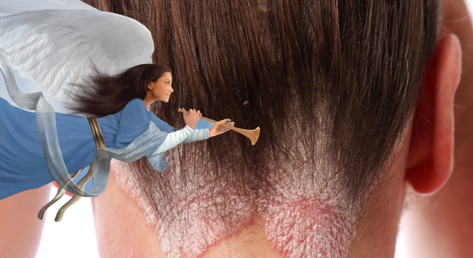 Taltz Psoriasis Commercial Music Sounds Familiar